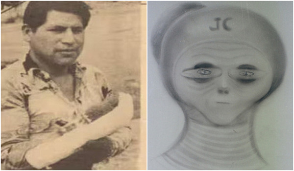 O intrigante e controverso caso de um peruano que, após um acidente envolvendo uma provável abdução, ficou ferido, mas teria sido curado por seres extraterrestres e desenvolvido impressionantes habilidades.